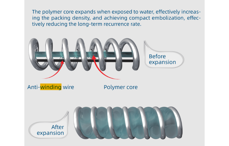 The Perfiller Expansible Embolic Coil System features a hydrogel polymer filament that expands upon ...