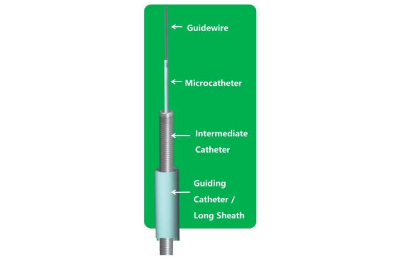 Neurointerventional Access