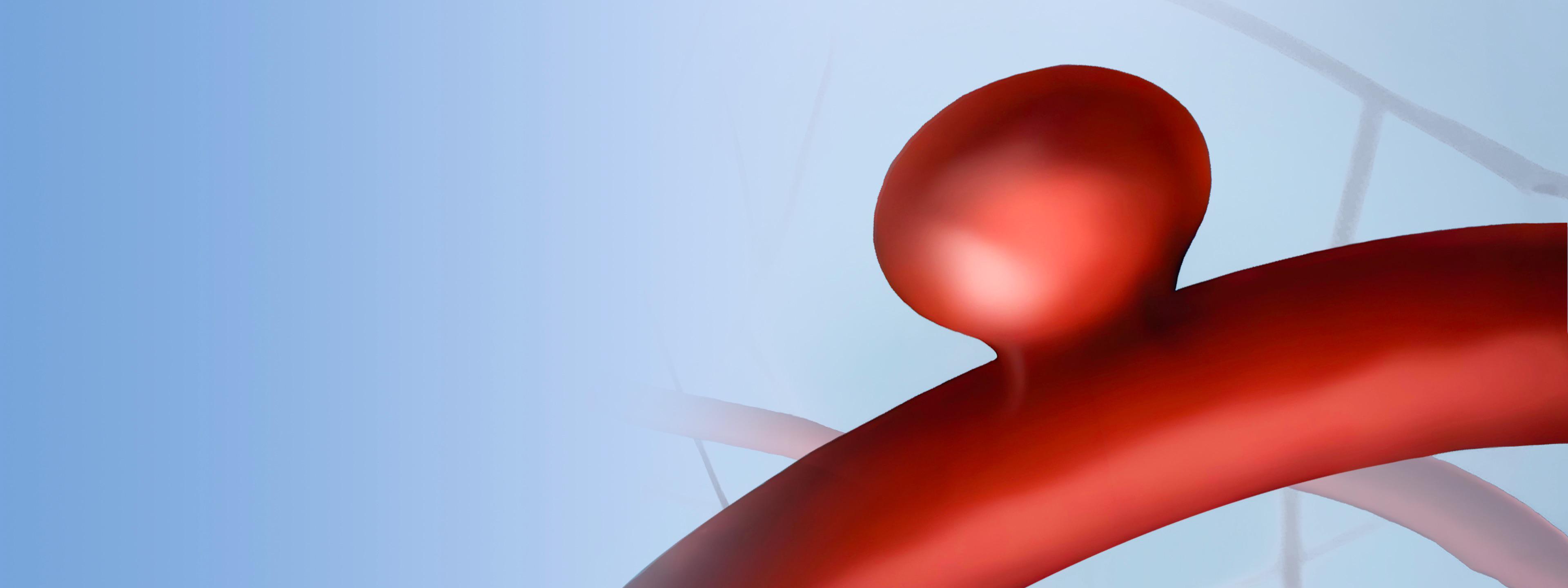 Hemorrhagic Stroke Solutions