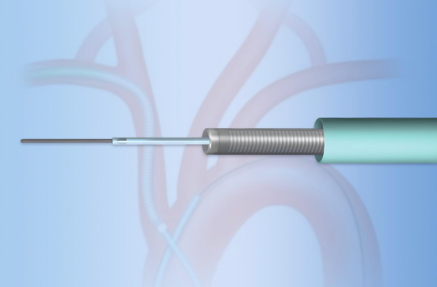 Neurointerventional Access